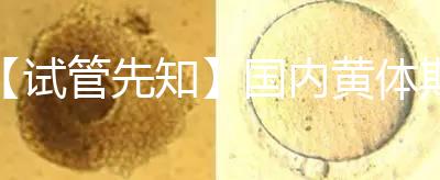 【試管先知】國內黃體期方案經驗緊缺,2點促排弊端需了解