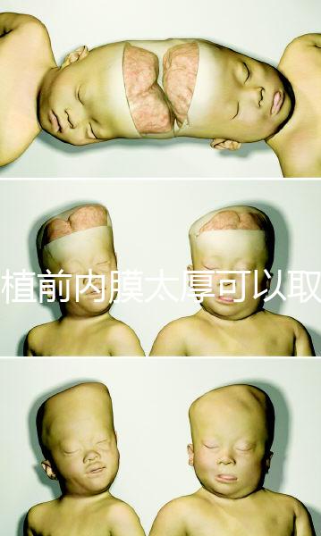 移植前內膜太厚可以取卵早知道，疼痛因人而異