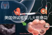 美國做試管嬰兒大概要花多少錢？具體支出25w！