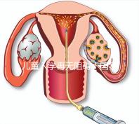 兒童入學再無阻礙!國家現已禁止體檢中檢查乙肝