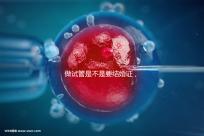 做試管是不是要結(jié)婚證，做試管需要結(jié)婚證