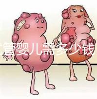 做試管嬰兒需多少錢?湘潭婦幼o(hù)r中心醫(yī)院花費(fèi)明細(xì)看這里