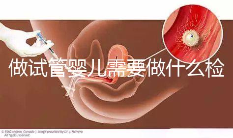 做試管嬰兒需要做什么檢查（做試管嬰兒需要做什么檢查？）