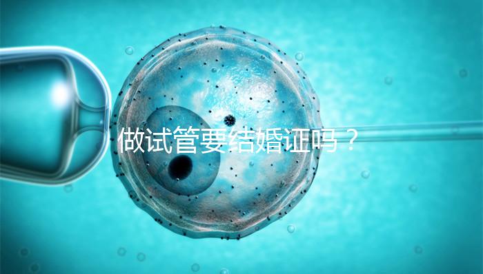 做試管要結(jié)婚證嗎？