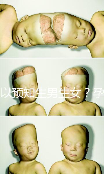 可以預知生男生女？孕婦夢見馬的胎夢解讀