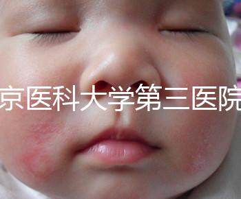 北京醫(yī)科大學(xué)第三醫(yī)院nt檢查費用盤點需要多長時間,是否預(yù)約