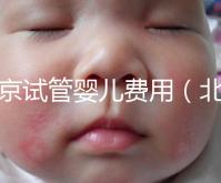 北京試管嬰兒費用(北京試管嬰兒費用大概要多少錢)