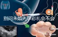 別問未婚先孕彩禮會不會少了,一分不給也不無可能