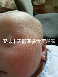 促排十天卵泡多大正?？催@，1.1×0.9符不符合一文說清