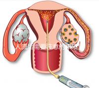 人流后需要注意的事項主要有哪些