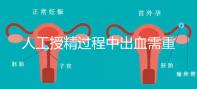 人工授精過(guò)程中出血需重視！這3種情況會(huì)影響成功率