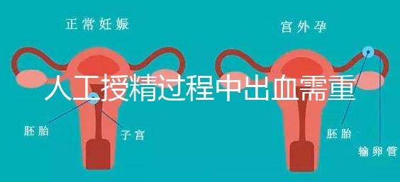人工授精過程中出血需重視!這3種情況會(huì)影響成功率