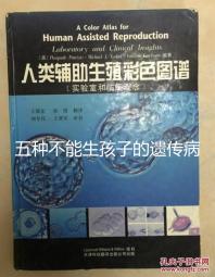 五種不能生孩子的遺傳病大公開，卟啉病能否要寶寶要早知