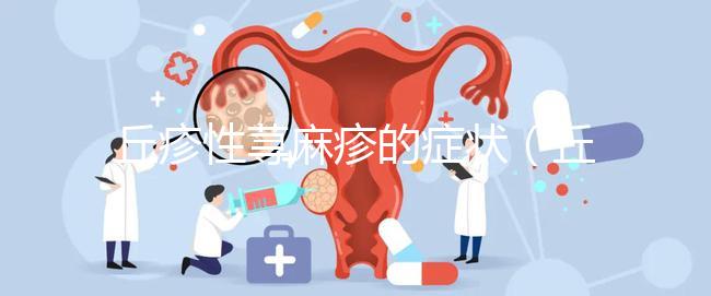 丘疹性蕁麻疹的癥狀(丘疹性蕁麻疹的癥狀表現)