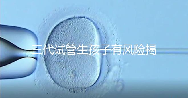三代試管生孩子有風險揭秘嗎？嬰兒會有問題嗎？