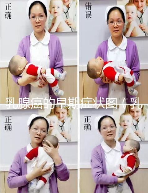 乳腺癌的早期癥狀圖(乳頭狀瘤早期圖片)