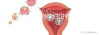 乳香氣味對(duì)孕婦沒有影響?致畸、導(dǎo)致流產(chǎn)不能忽視