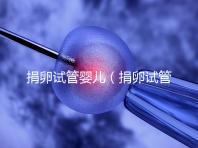 捐卵試管嬰兒（捐卵試管嬰兒費(fèi)用）