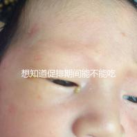 想知道促排期間能不能吃草莓看過來,怎么吃不發胖有講究