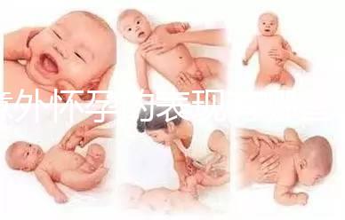 意外懷孕的表現有哪些呢