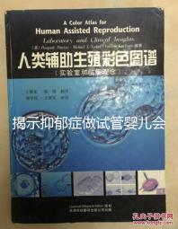 揭示抑郁癥做試管嬰兒會遺傳給女兒，想避免看這個