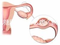 楓糖尿病是什么?。啃律鷥哼@5個(gè)指標(biāo)偏低要注意了