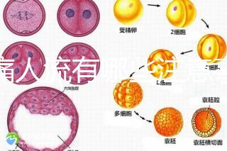 無痛人流有哪些注意事項？