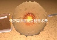 武漢同濟醫(yī)院采精手術(shù)費用分析,顯微采精也可報銷