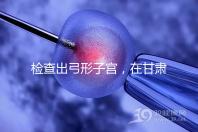 檢查出弓形子宮,在甘肅玉門(mén)能做試管嬰兒懷孕嗎?