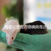 梅毒試管能否隱瞞病毒還沒有建造,備案記錄已經(jīng)通知