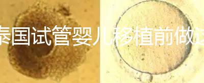 泰國(guó)試管嬰兒移植前做這3件事能提高成功率，不然會(huì)后悔！