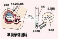 浙江三代試管最好的公立醫院推薦,參考性大隨你挑