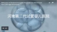 河南第三代試管嬰兒醫院整理，成功率、費用全在這