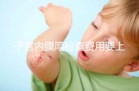 子宮內膜厚檢查費用要上千？那你絕對被忽悠了