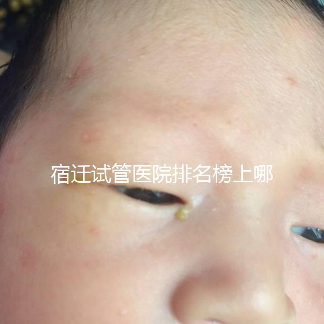 宿遷試管醫院排名榜上哪家好,不造助孕成功率和費用別亂選