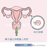 頭痛、惡心!除了這些優思明副作用還有哪些