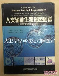大衛(wèi)早早孕試紙對(duì)照?qǐng)D解，教你怎么看結(jié)果是不是陽(yáng)性
