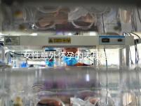 女性意外懷孕的表現是什么?