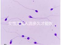 女性無痛人流多久才能恢復(fù)健康?