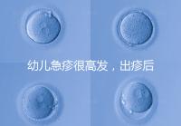 幼兒急疹很高發，出疹后的護理方法及注意事項提前知曉！