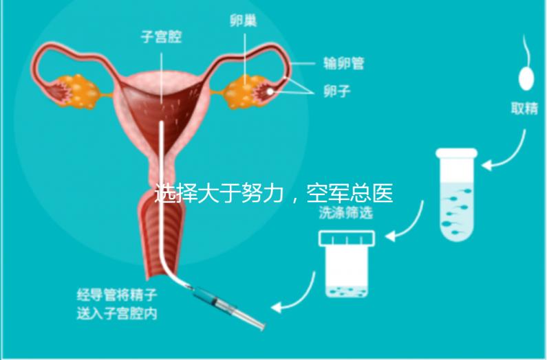 選擇大于努力,空軍總醫(yī)院做試管嬰兒必讀攻略
