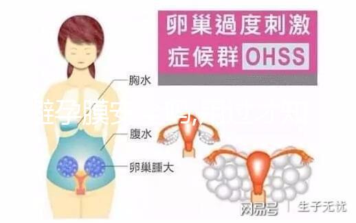 避孕膜安全嗎,用過才知道3點(diǎn)注意事項(xiàng)