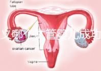 遵義哪個(gè)試管嬰兒成功率高?貴州生殖中心醫(yī)院2024年排名參考