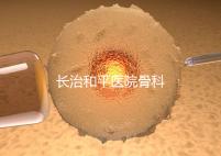 長治和平醫院骨科