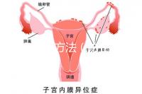 防止暈厥方法(防止暈厥方法有哪些)