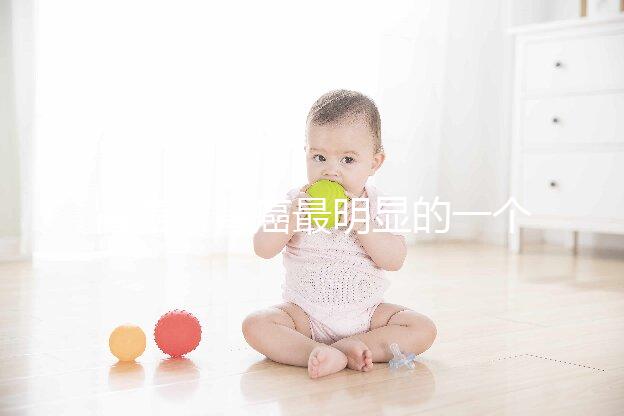 腎癌(腎癌最明顯的一個(gè)征兆)