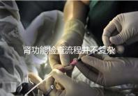 腎功能檢查流程并不復雜，掌握這幾個步驟方可一步到位