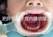 肥胖引起子宮內膜增厚,怎么治療在于患者年齡