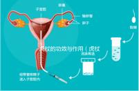 虎杖的功效與作用(虎杖到底是保肝還是傷肝)