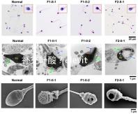 補充葉酸？elevit愛樂維那你不得不了解